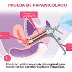 Prueba de Papanicolaou, todo lo que necesita saber